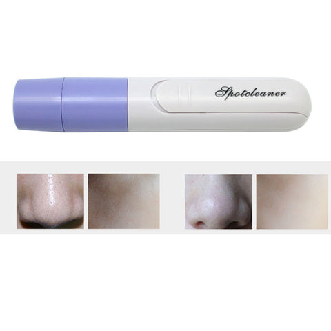Facial Pore Skin Cleaner